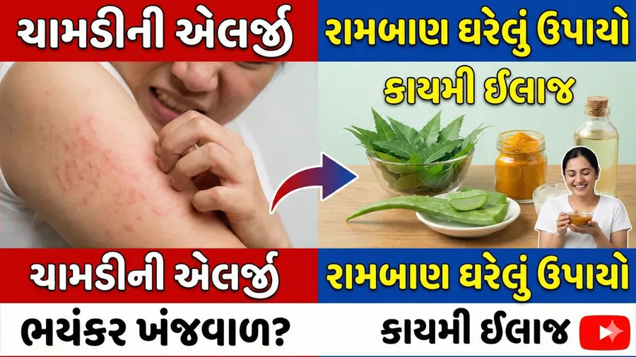 ચામડીની એલર્જી
