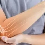 ઑસ્ટિયોપોરોસિસ (Osteoporosis)