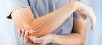 ઑસ્ટિયોપોરોસિસ (Osteoporosis)