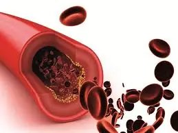 કોલેસ્ટ્રોલ (Cholesterol)