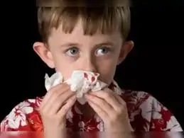 નસકોરી ફૂટવી (Nosebleed)