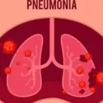 ન્યુમોનિયા (Pneumonia)
