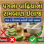 પગમાં ચીરા પડ્યા હોય તો શું કરવાનું