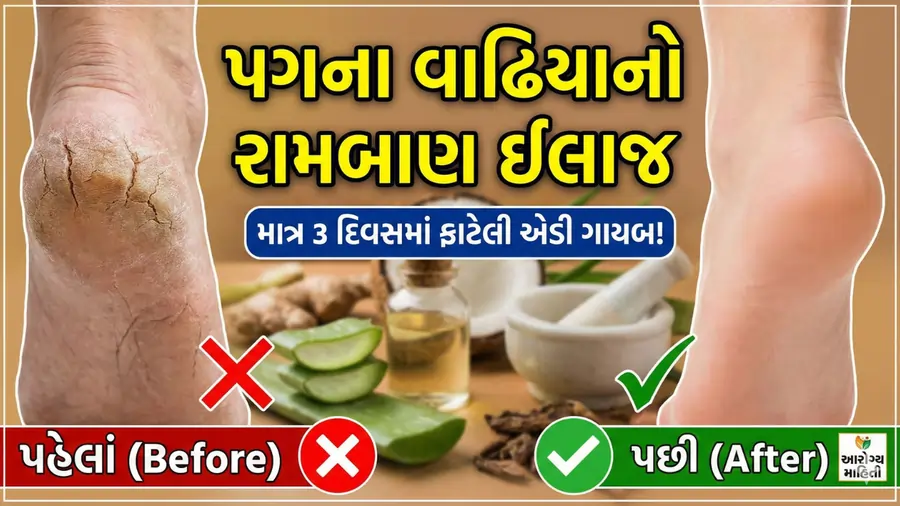 પગમાં ચીરા પડ્યા હોય તો શું કરવાનું