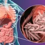 પેટના કૃમિ (કરમિયા) નો ઈલાજ.