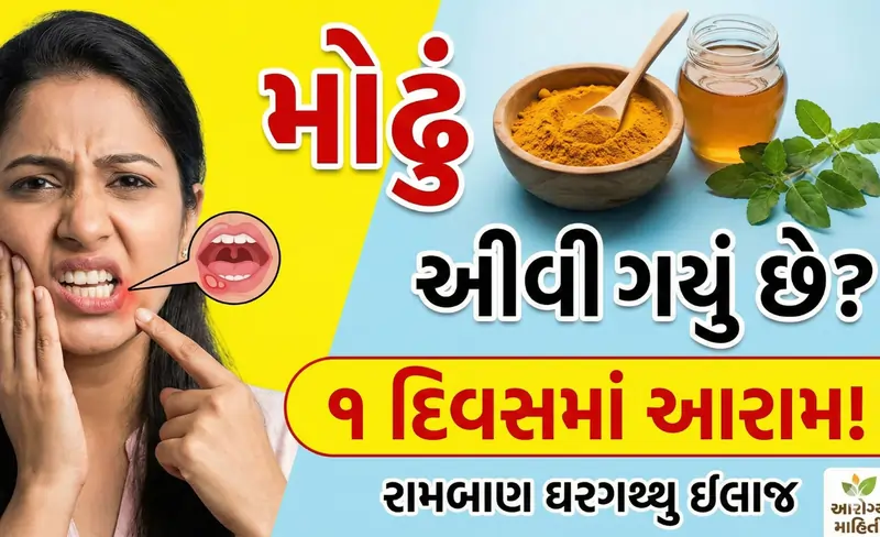 મોઢું આવી ગયું હોય તો શું કરવું