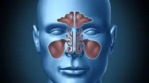 સાઈનસ (Sinusitis)