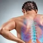 સાયટિકા (Sciatica)