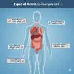 હર્નિયા એટલે શું