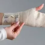 હાડકું ભાંગવું (Fracture)