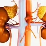 આલ્બ્યુમિન્યુરિયા (Albuminuria)
