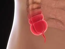 એપેન્ડિક્સ (Appendix)