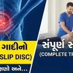 કમરની ગાદીનો દુખાવો (Slip Disc) કારણો, લક્ષણો અને સારવાર
