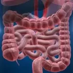 કોલાઈટિસ (Colitis)