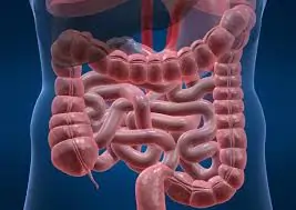 કોલાઈટિસ (Colitis)