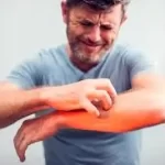 ખંજવાળ (Itching)