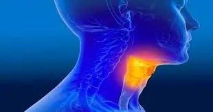 ગળાનું કેન્સર (Throat Cancer)