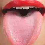 જીભના રોગો (Tongue Diseases)