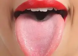 જીભના રોગો (Tongue Diseases)