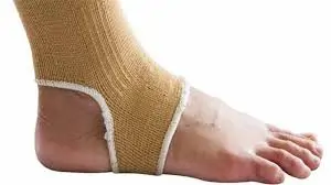 મચકોડ (Sprain)