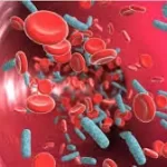 લોહીના ઝેર (Septicemia)