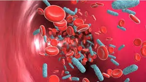 લોહીના ઝેર (Septicemia)