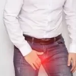 હાઈડ્રોસેલ (Hydrocele)