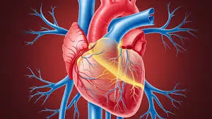 હાર્ટ બ્લોકેજ (Heart Blockage)