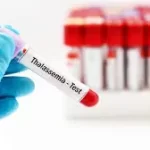 થેલેસેમિયા (Thalassemia)
