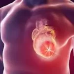 રુમેટિક હાર્ટ ડિસીઝ (Rheumatic Heart Disease)