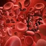 હીમોફીલિયા (Hemophilia)