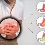 ગેસ અને ગોટલો થવાની સમસ્યાનો કાયમી ઉકેલ