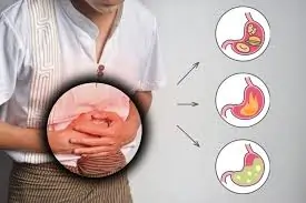 ગેસ અને ગોટલો થવાની સમસ્યાનો કાયમી ઉકેલ