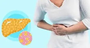 ફેટી લિવર (Fatty Liver) ના લક્ષણો અને તેનો આયુર્વેદિક ઈલાજ