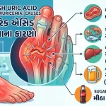 યુરિક એસિડ વધવાના કારણો