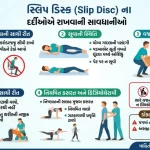 સ્લિપ ડિસ્ક