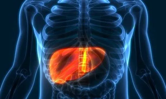 આલ્કોહોલ પીધા વગર પણ ફેટી લિવર કેમ થાય છે? (NAFLD)
